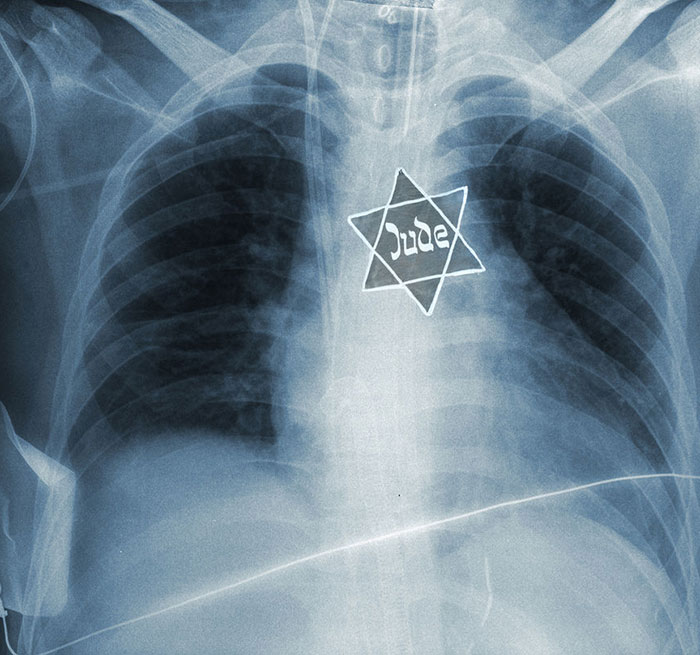 הגֶּן